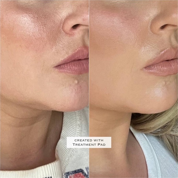 NATURE’S BOTOX IN A BOTTLE - Picture 6 of 9